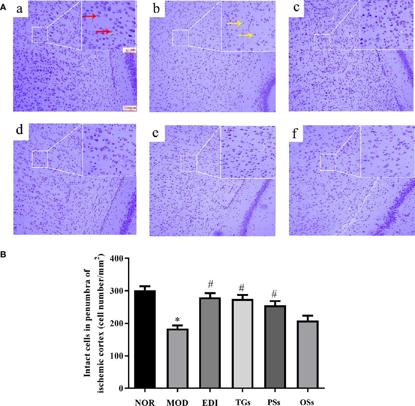 Cistanche deserticola total glycosides reduce neuronal damage and increase intact neurons in I/R-injured rats, shown by Nissl staining and quantification.